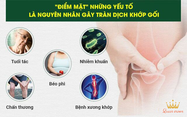 #Tổng Hợp 13 Chấn Thương Khi Chạy Bộ Thường Gặp Và Cách Khắc Phục