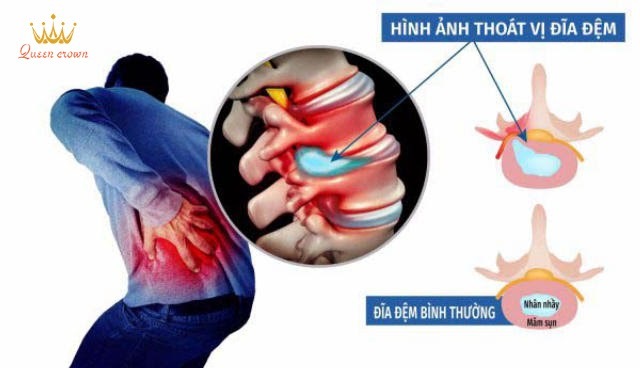 đau nhức xương khớp ở người già